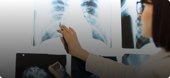 chest xray in pediatric xray